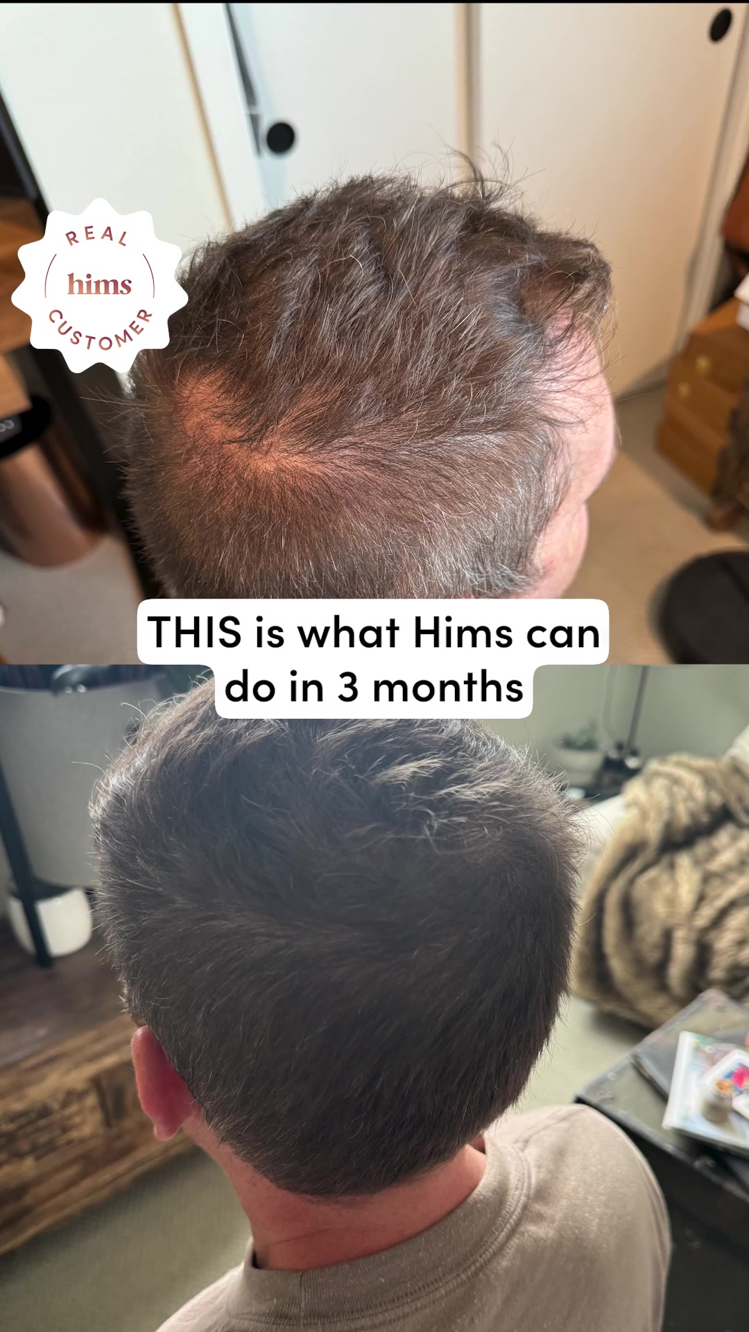 Hims — Facebook ad