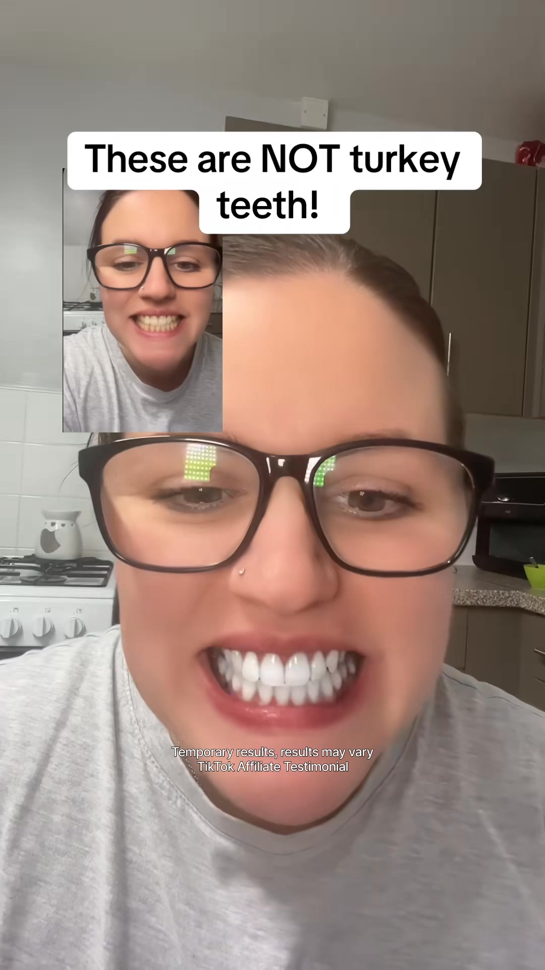 Hismile — Facebook ad